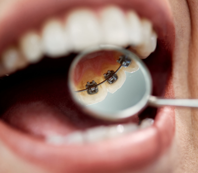 Children's Dentistry